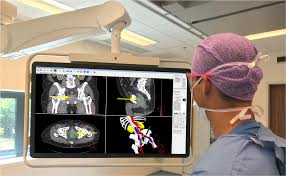 Surgical Navigation